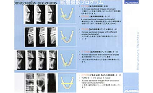 断層撮影プログラム